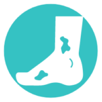 Diabetic-Foot